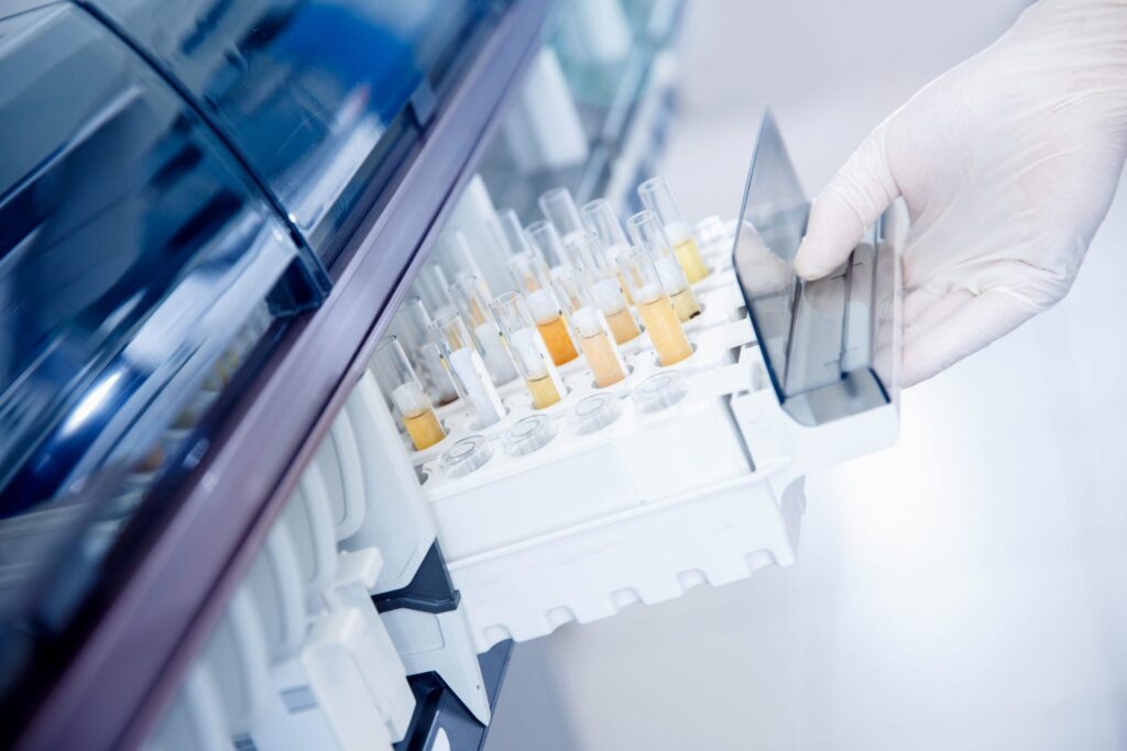 A lot of test tubes being put away by somebody wearing a glove, representing how one can benefit from calling a Portland criminal defense lawyer.