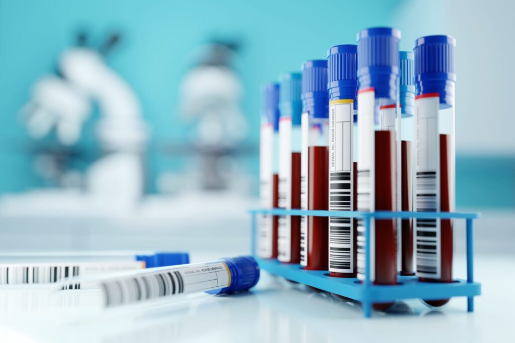 A medical office showing several tubes with blood samples, representing how one can benefit from calling a Portland criminal defense lawyer.